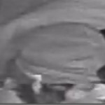 Suspect1a